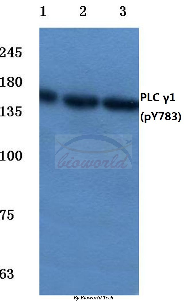 Western blot (WB) analysis of p-PLC γ1 (Y783) pAb at 1:500 dilution Lane1:HEK293T cell lysate treated with UV Lane2:NIH-3T3 cell lysate treated with LPS Lane3:PC12 cell lysate treated with H2O2