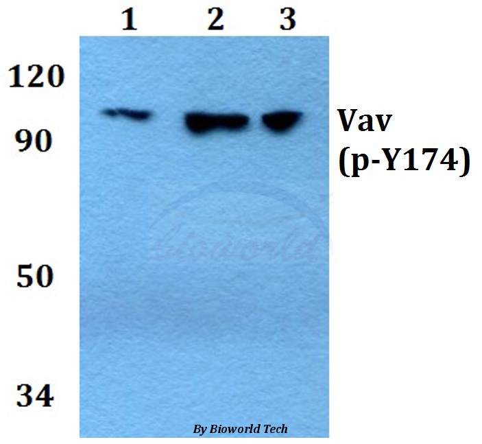 Western blot (WB) analysis of p-Vav1(Y174) pAb at 1:500 dilution Lane1:Hela cell lysate treated with UV(4h) Lane2:sp2/0 cell lysate treated with UV(4h) Lane3:PC12 cell lysate treated with UV(4h)