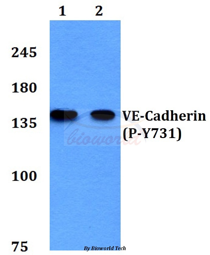 Western blot (WB) analysis of p-VE-Cadherin (Y731) pAb at 1:500 dilution Lane1:Hela cell lysate treated with EGF(0.1ng/ml,30mins) Lane2:H9C2 cell lysate treated with EGF(0.1ng/ml,30mins)