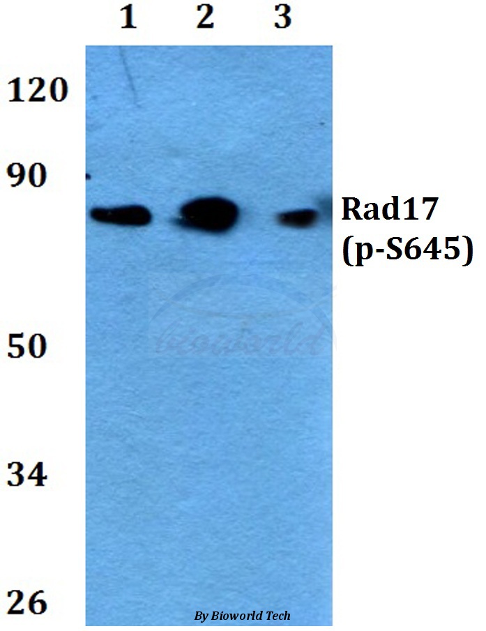 Western blot (WB) analysis of p-Rad17 (S645) pAb at 1:500 dilution Lane1:Hela cell lysate treated with UV(4h) Lane2:Raw264.7 cell lysate treated with UV(24h) Lane3:PC12 cell lysate treated with UV(4h)