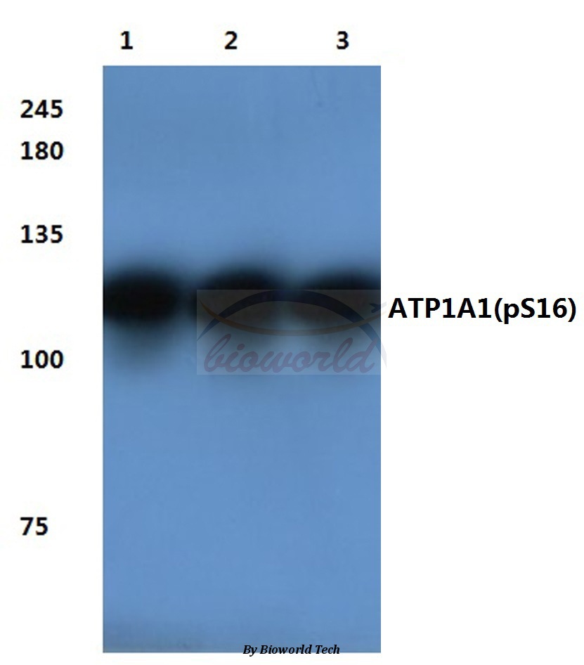 Western blot (WB) analysis of p-Na+/K+-ATPase α1 (S16) pAb at 1:500 dilution Lane1:MCF-7 cell lysate Lane2:Hela cell lysate Lane3:Raw264.7 cell lysate