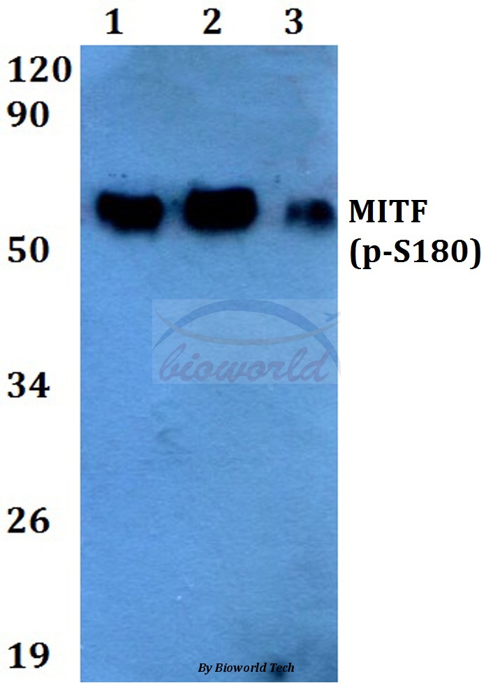 Western blot (WB) analysis of p-MITF (S180) pAb at 1:500 dilution Lane1:HEK293T cell lysate Lane2:Raw264.7 cell lysate Lane3:PC12 cell lysate