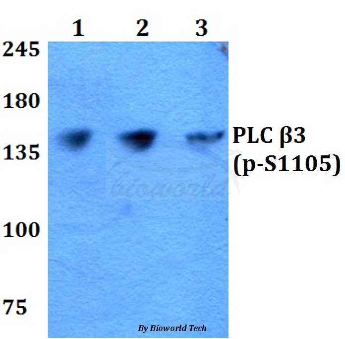Western blot (WB) analysis of p-PLC β3 (S1105) pAb at 1:500 dilution Lane1:HEK293T whole cell lysate Lane2:Raw264.7 whole cell lysate Lane3:PC12 whole cell lysate