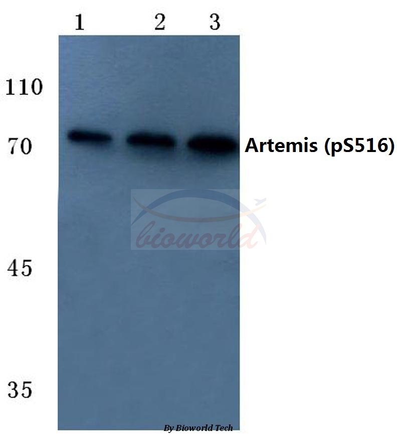 Western blot (WB) analysis of p-Artemis (S516) pAb at 1:500 dilution Lane1:HEK293T cell lysate Lane2:Mouse skeletal muscle tissue lysate Lane3:Rat skeletal muscle tissue lysate