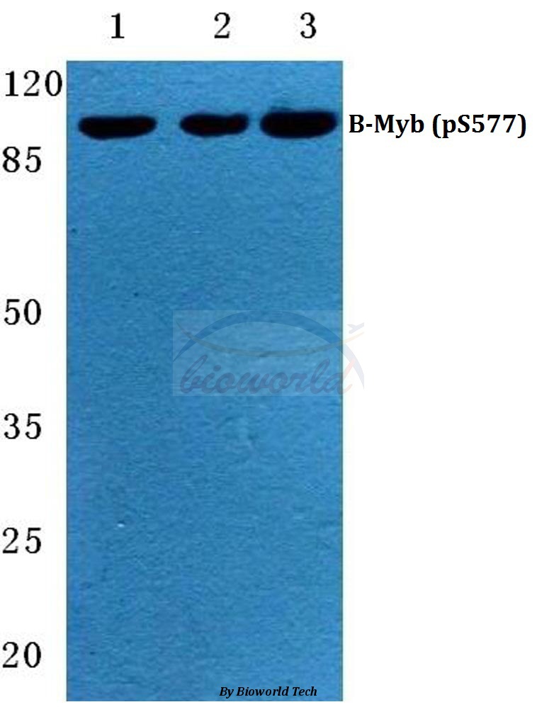 Western blot (WB) analysis of p-B-Myb (S577) pAb at 1:500 dilution Lane1:MCF-7 cell lysate Lane2:Mouse liver tissue lysate Lane3:Rat liver tissue lysate