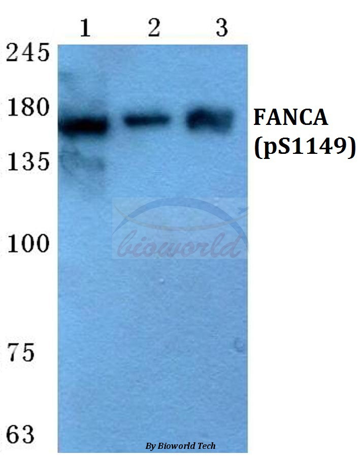 Western blot (WB) analysis of p-FANCA (S1149) pAb at 1:500 dilution Lane1:HepG2 cell lysate treated with EGF(0.1ng/ML,30mins) Lane2:sp2/0 cell lysate treated with EGF(0.1ng/ML,30mins) Lane3:H9C2 cell lysate treated with EGF(0.1ng/ML,30mins)
