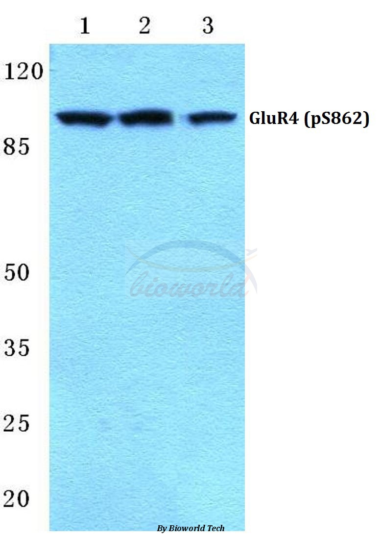 Western blot (WB) analysis of p-GluR4 (S862) pAb at 1:500 dilution Lane1:MCF-7 cell lysate treated with Forskolin(10nM,24h) Lane2:Mouse spleen tissue lysate Lane3:Rat spleen tissue lysate
