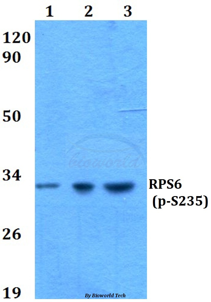 Western blot (WB) analysis of p-RPS6 (S235) pAb at 1:500 dilution Lane1:HEK293T cell lysate treated with colchicine(0.2ng/ml,24h) Lane2:sp2/0 cell lysate treated with colchicine(0.2ng/ml,24h) Lane3:H9C2 cell lysate treated with colchicine(0.2ng/ml,24h)