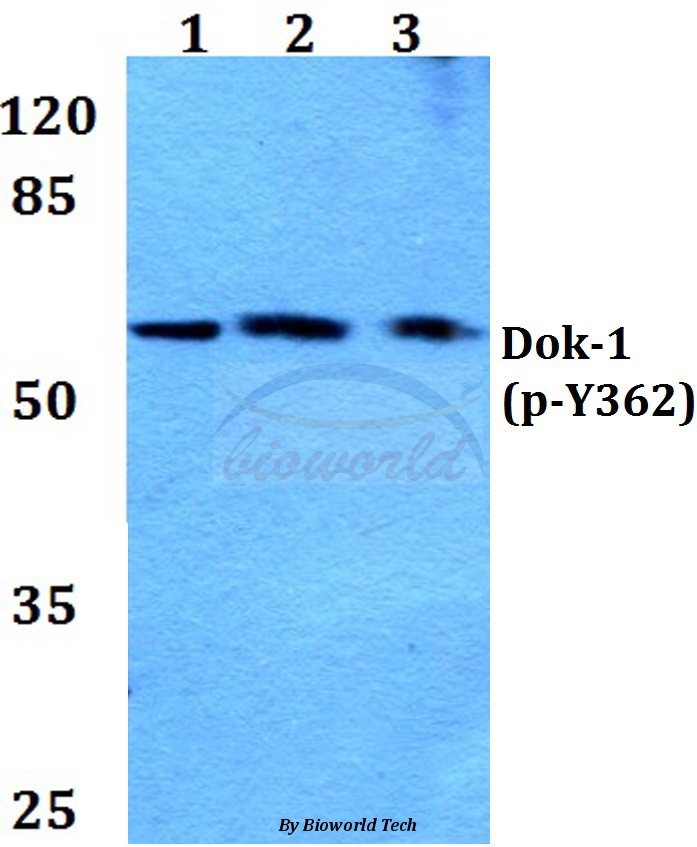Western blot (WB) analysis of p-Dok-1 (Y362) pAb at 1:500 dilution Lane1:HEK293T whole cell lysate Lane2:Raw264.7 whole cell lysate Lane3:PC12 whole cell lysate