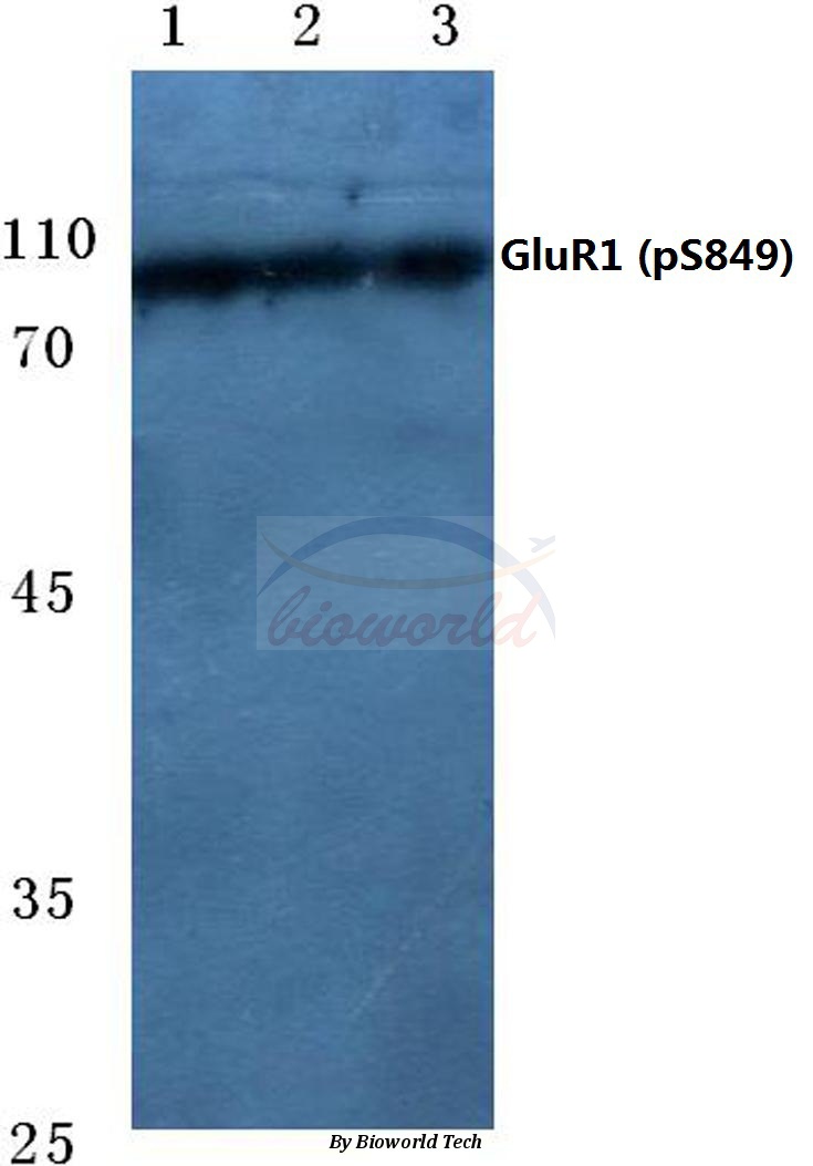 Western blot (WB) analysis ofp-GluR1 (S849) pAb at 1:500 dilution Lane1:Jurkat cell lysate Lane2:Mouse kidney tissue lysate Lane3:Rat liver tissue lysate