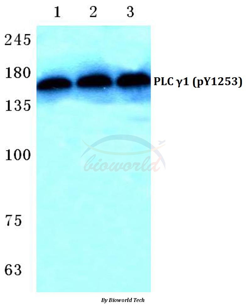 Western blot (WB) analysis of p-PLC γ1 (Y1253) pAb at 1:500 dilution Lane1:MCF-7 cell lysate treated with EGF(0.1ng/ML,30mins) Lane2:Mouse liver tissue lysate Lane3:H9C2 cell lysate treated with EGF(0.1ng/ML,30mins)