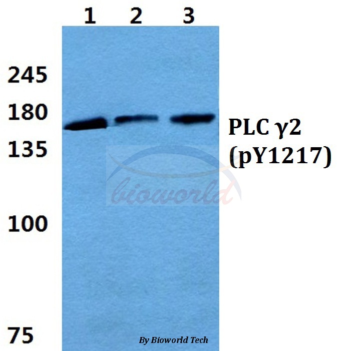 Western blot (WB) analysis of p-PLC γ2 (Y1217) pAb at 1:500 dilution Lane1:HEK293T cell lysate treated with EGF(0.1ng/ML,30mins) Lane2:sp2/0 cell lysate treated with EGF(0.1ng/ML,30mins) Lane3:H9C2 cell lysate treated with EGF(0.1ng/ML,30mins)