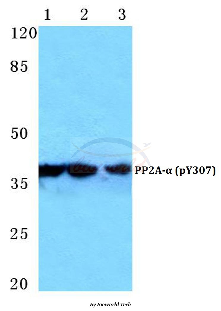 Western blot (WB) analysis of p-PP2A-α (Y307) pAb at 1:500 dilution Lane1:HEK293T cell treated with EGF(0.1ng/ML,30min) Lane2:Mouse brain tissue lysate Lane3:H9C2 cell treated with EGF(0.1ng/ML,30min)