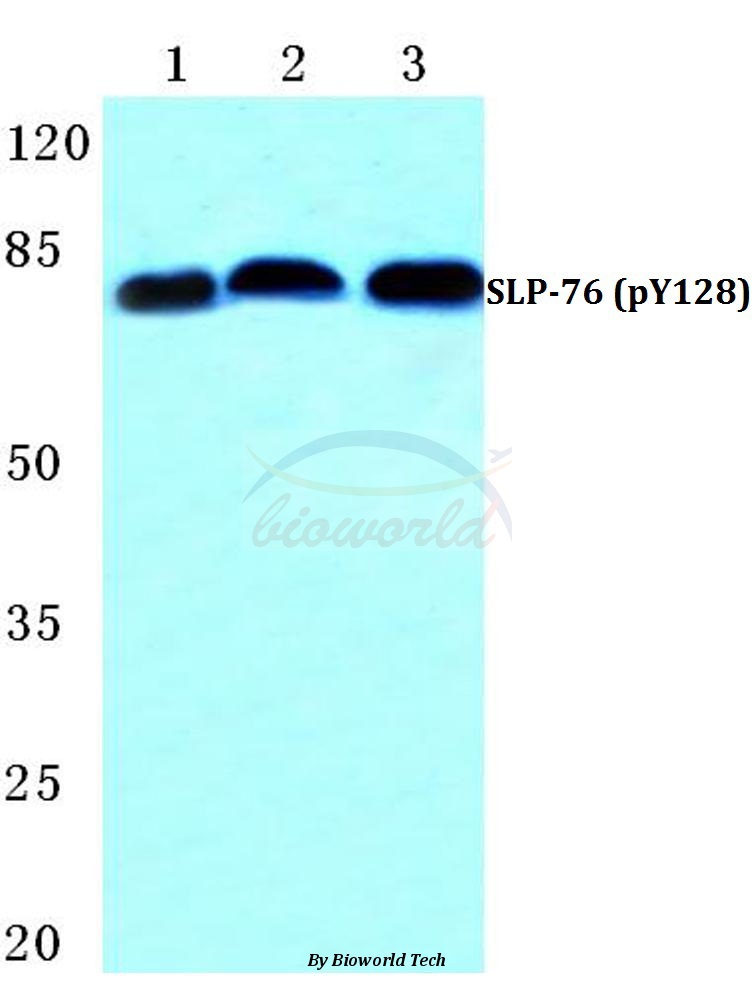 Western blot (WB) analysis of p-SLP-76 (Y128) pAb at 1:500 dilution Lane1:Hela cell treated with H2O2(100µM,30min) Lane2:Raw264.7 cell treated with H2O2(100µM,30min) Lane3:PC12 cell treated with H2O2(100µM,30min)