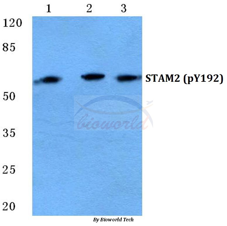Western blot (WB) analysis of p-STAM2 (Y192) pAb at 1:500 dilution Lane1:HEK293T cell treated with EGF(0.1ng/ML,30min) Lane2:sp2/0 cell treated with EGF(0.1ng/ML,30min) Lane3:Rat spleen tissue lysate