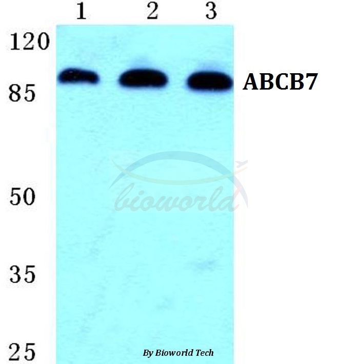 Western blot (WB) analysis of ABCB7 pAb at 1:500 dilution Lane1:Hela cell lysate Lane2:Raw264.7 cell lysate Lane3:PC12 cell lysate