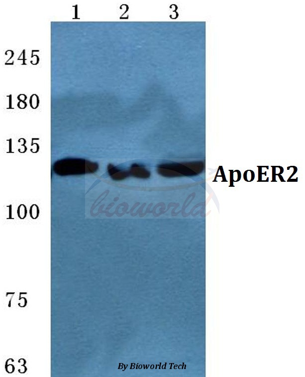 Western blot (WB) analysis of ApoER2 pAb at 1:500 dilution Lane1:MCF-7 cell lysate Lane2:NIH-3T3 cell lysate Lane3:H9C2 cell lysate