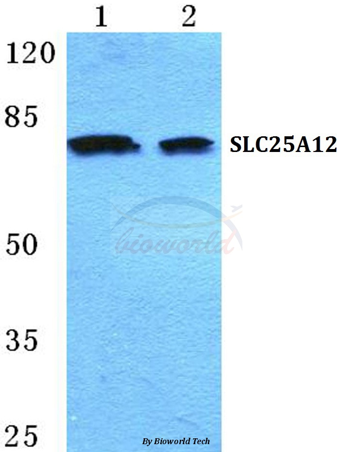 Western blot (WB) analysis of SLC25A12 pAb at 1:500 dilution Lane1:Jurkat cell lysate Lane2:Rat liver tissue lysate