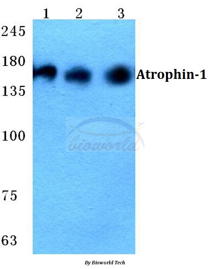 Western blot (WB) analysis of Atrophin-1 pAb at 1:500 dilution Lane1:HEK293T cell lysate Lane2:sp2/0 cell lysate Lane3:H9C2 cell lysate