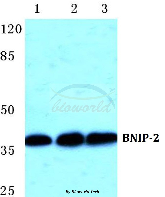 Western blot (WB) analysis of BNIP-2 pAb at 1:500 dilution Lane1:Hela cell lysate Lane2:Raw264.7 cell lysate Lane3:PC12 cell lysate