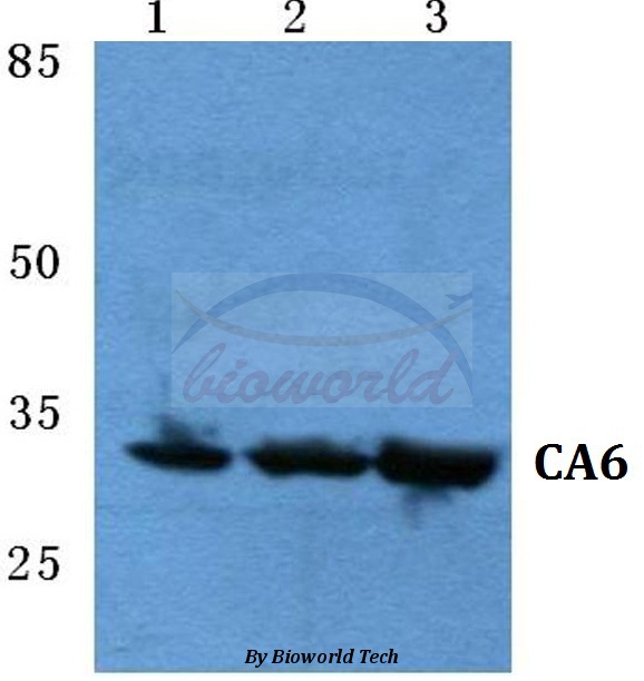 Western blot (WB) analysis of CA6 pAb at 1:500 dilution Lane1:HEK293T cell lysate Lane2:sp2/0 cell lysate Lane3:H9C2 cell lysate