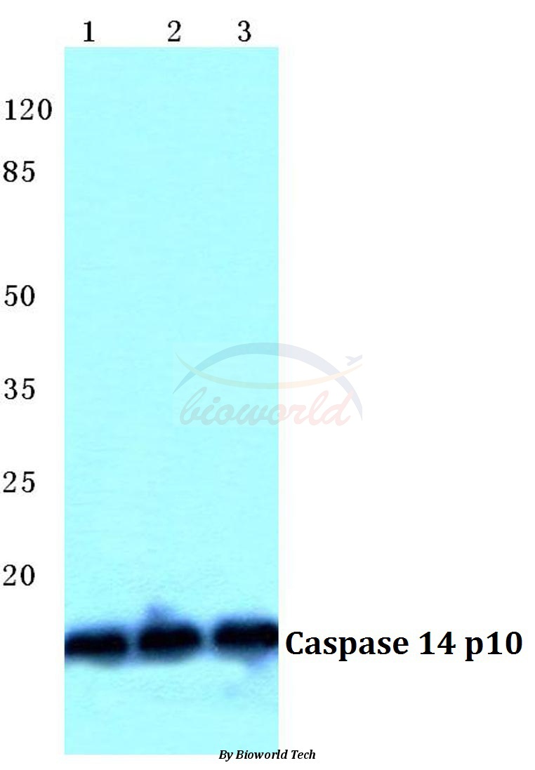 Western blot (WB) analysis of Caspase 14 p10 pAb at 1:500 dilution Lane1:MCF-7 cell lysate Lane2:Mouse spleen tissue lysate Lane3:Rat liver tissue lysate