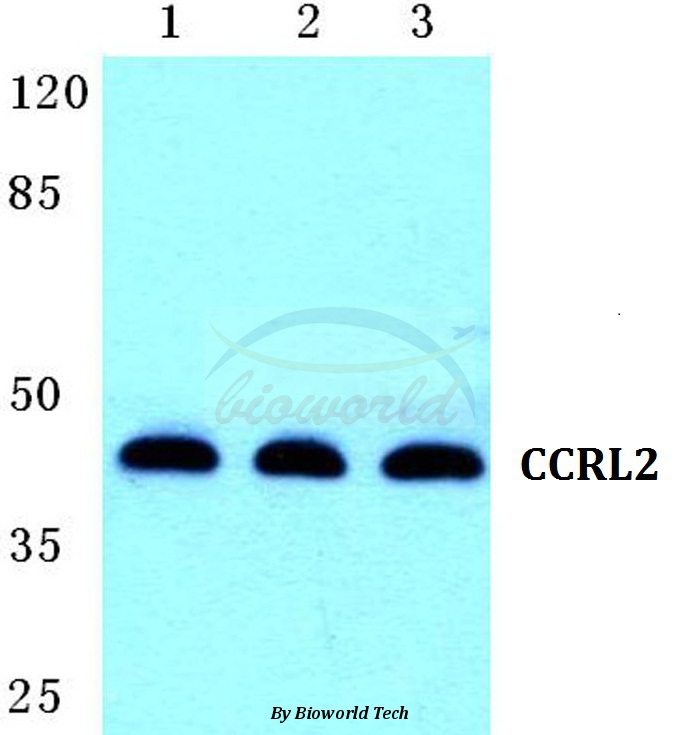 Western blot (WB) analysis of CCRL2 pAb at 1:500 dilution Lane1:Hela cell lysate Lane2:Mouse brain tissue lysate Lane3:Rat brain tissue lysate