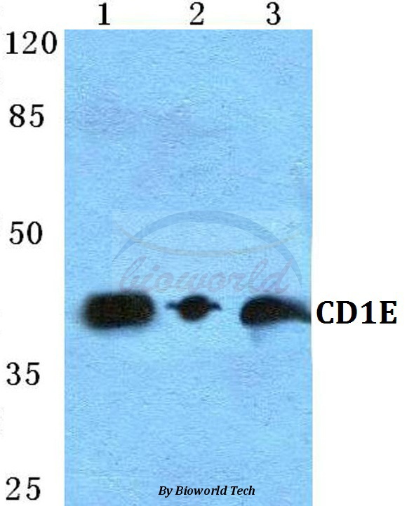 Western blot (WB) analysis of CD1E pAb at 1:500 dilution Lane1:Hela cell lysate Lane2:sp2/0 cell lysate Lane3:H9C2 cell lysate