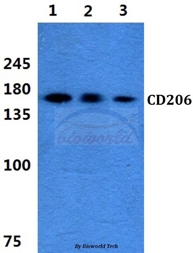 Western blot (WB) analysis of CD206 pAb at 1:500 dilution Lane1:MCF-7 cell lysate Lane2:sp2/0 cell lysate Lane3:H9C2 cell lysate