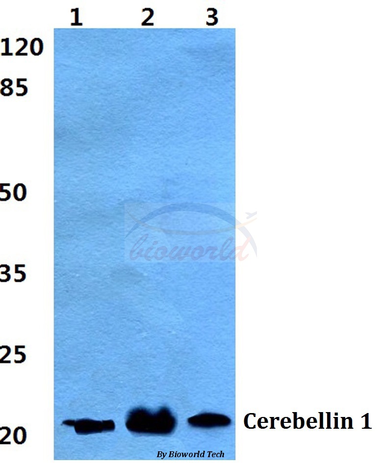 Western blot (WB) analysis of Cerebellin 1 pAb at 1:500 dilution Lane1:HEK293T cell lysate Lane2:sp2/0 cell lysate Lane3:PC12 cell lysate