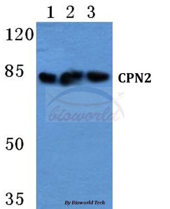 Western blot (WB) analysis of CPN2 pAb at 1:500 dilution Lane1:MCF-7 cell lysate Lane2:Hela cell lysate Lane3:Raw264.7 cell lysate