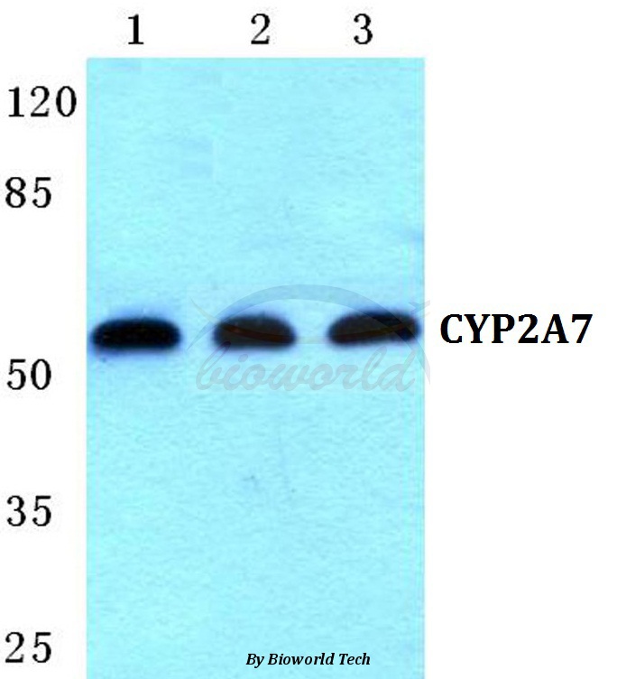 Western blot (WB) analysis of CYP2A7 pAb at 1:500 dilution Lane1:Hela cell lysate Lane2:sp2/0 cell lysate Lane3:PC12 cell lysate