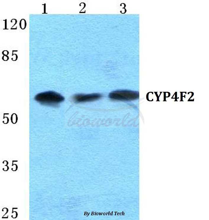 Western blot (WB) analysis of CYP4F2 pAb at 1:500 dilution Lane1:Hela cell lysate Lane2:NIH-3T3 cell lysate Lane3:PC12 cell lysate