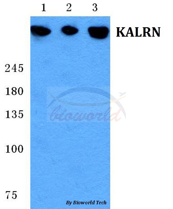 Western blot (WB) analysis of KALRN pAb at 1:500 dilution Lane1:HEK293T cell lysate Lane2:NIH-3T3 cell lysate Lane3:H9C2 cell lysate