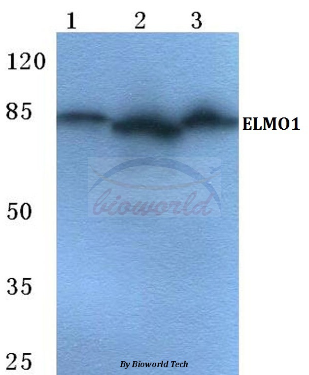 Western blot (WB) analysis of ELMO1 pAb at 1:500 dilution Lane1:MCF-7 cell lysate Lane2:sp2/0 cell lysate Lane3:Rat brain tissue lysate