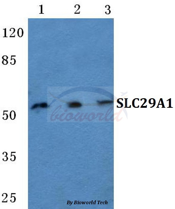 Western blot (WB) analysis of SLC29A1 pAb at 1:500 dilution Lane1:Hela cell lysate Lane2:Raw264.7 cell lysate Lane3:PC12 cell lysate