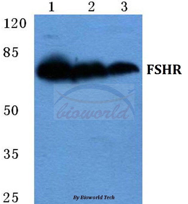 Western blot (WB) analysis of FSHR pAb at 1:500 dilution Lane1:HEK293T cell lysate Lane2:NIH-3T3 cell lysate Lane3:H9C2 cell lysate