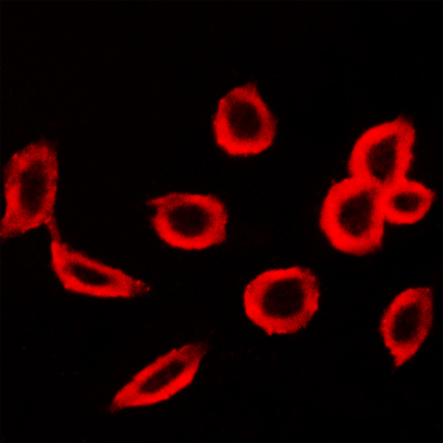 Immunocytochemistry stain of A549 cells using FSHR antibody (1:200).