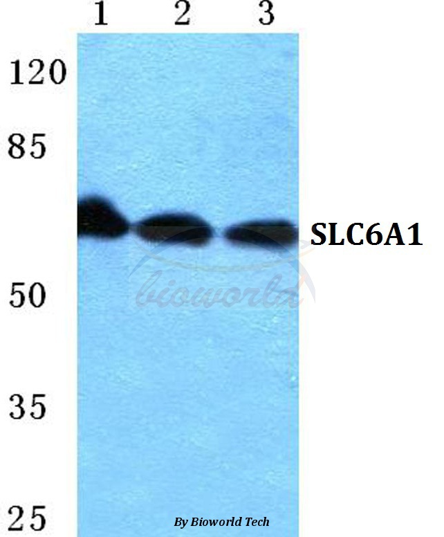 Western blot (WB) analysis of SLC6A1 pAb at 1:500 dilution Lane1:Hela cell lysate Lane2:Raw264.7 cell lysate Lane3:H9C2 cell lysate