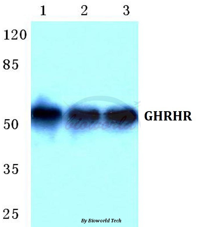 Western blot (WB) analysis of GHRHR pAb at 1:500 dilution Lane1:Hela cell lysate Lane2:Mouse liver tissue lysate Lane3:Rat liver tissue lysate