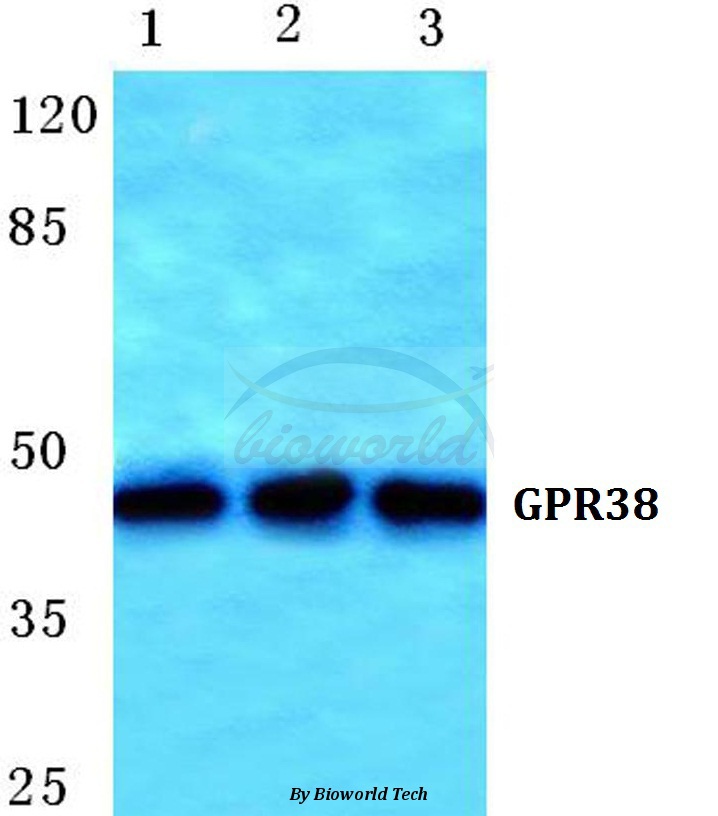 Western blot (WB) analysis of GPR38 pAb at 1:500 dilution Lane1:HEK293T cell lysate Lane2:sp2/0 cell lysate Lane3:NIH-3T3 cell lysate