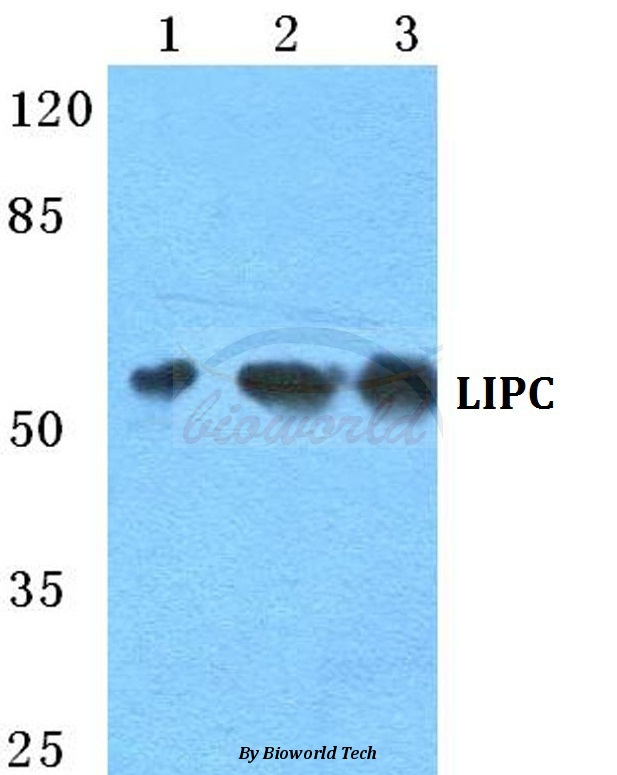 Western blot (WB) analysis of LIPC pAb at 1:500 dilution Lane1:HEK293T cell lysate Lane2:NIH-3T3 cell lysate Lane3:H9C2 cell lysate