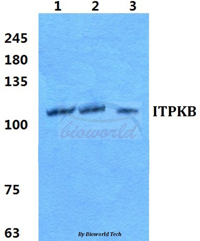 Western blot (WB) analysis of ITPKB pAb at 1:500 dilution Lane1:Hela cell lysate Lane2:sp2/0 cell lysate Lane3:H9C2 cell lysate