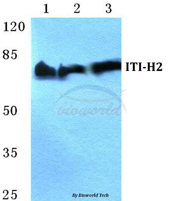 Western blot (WB) analysis of ITI-H2 pAb at 1:500 dilution Lane1:MCF-7 cell lysate Lane2:Mouse brain tissue lysate Lane3:Rat brain tissue lysate