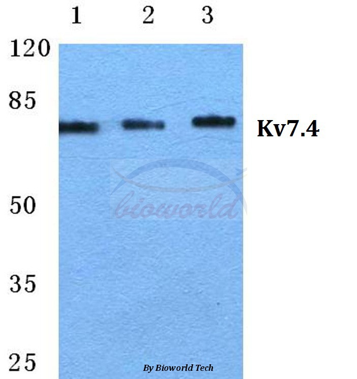 Western blot (WB) analysis of Kv7.4 pAb at 1:500 dilution Lane1:Hela cell lysate Lane2:Mouse liver tissue lysate Lane3:Rat liver tissue lysate