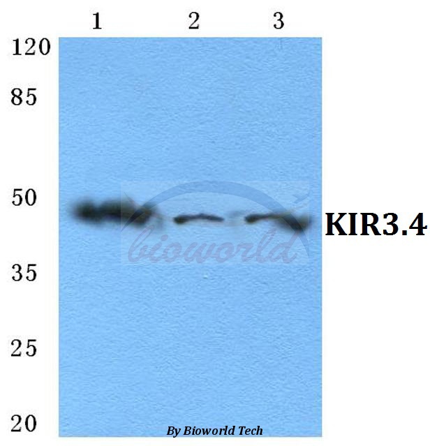 Western blot (WB) analysis of KIR3.4 pAb at 1:500 dilution Lane1:MCF-7 cell lysate Lane2:Raw264.7 cell lysate Lane3:PC12 cell lysate