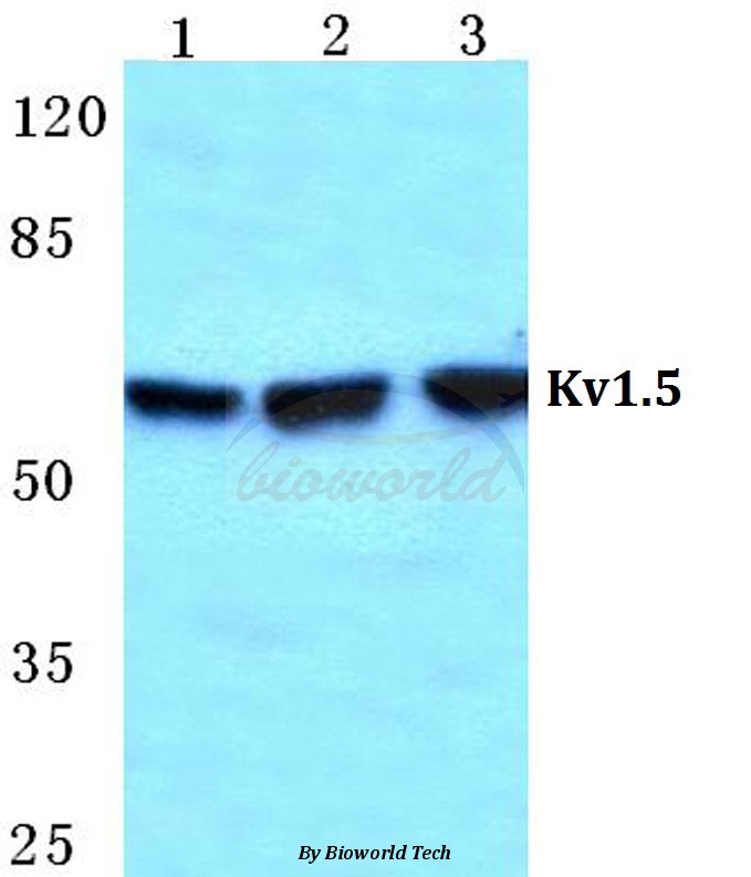 Western blot (WB) analysis of Kv1.5 pAb at 1:500 dilution Lane1:MCF-7 cell lysate Lane2:Raw264.7 cell lysate Lane3:H9C2 cell lysate