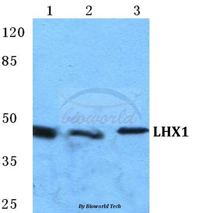 Western blot (WB) analysis of LHX1 pAb at 1:500 dilution Lane1:HEK293T cell lysate Lane2:sp2/0 cell lysate Lane3:H9C2 cell lysate
