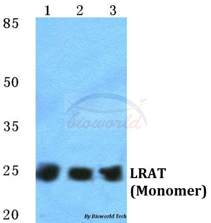 Western blot (WB) analysis of LRAT pAb at 1:500 dilution Lane1:HEK293T cell lysate Lane2:sp2/0 cell lysate Lane3:H9C2 cell lysate
