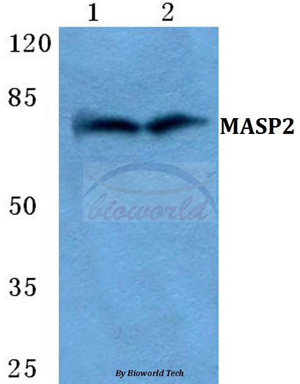 Western blot (WB) analysis of MASP2 pAb at 1:500 dilution Lane1:Hela cell lysate Lane2:sp2/0 cell lysate